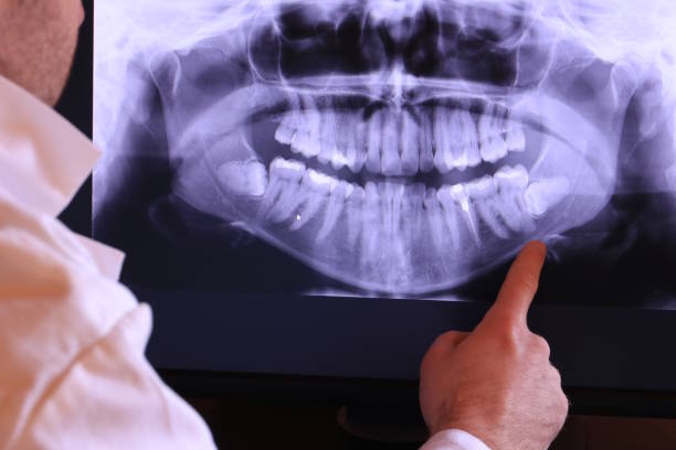 Best Emergency Dental Care for Abscessed Tooth in Moorestown Lenola, NJ